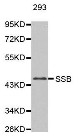 Western blot analysis of extracts of 293 cell line using La Antigen antibody