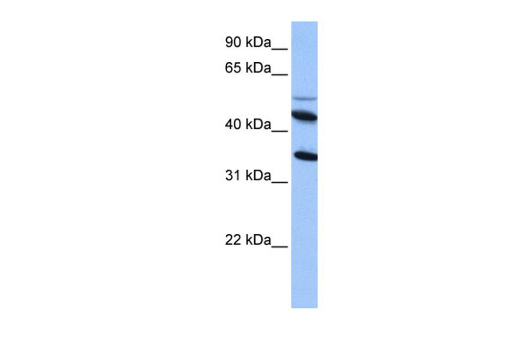 Antibody used in WB on Human HepG2 at 0.2-1 ug/ml.