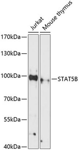 Western blot - STAT5B antibody (A12356)