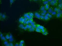 Immunocytochemistry/Immunofluorescence: USP9x Antibody [NBP1-48321] - Immunocytochemical analysis of USP9X in NTERA-2 cells