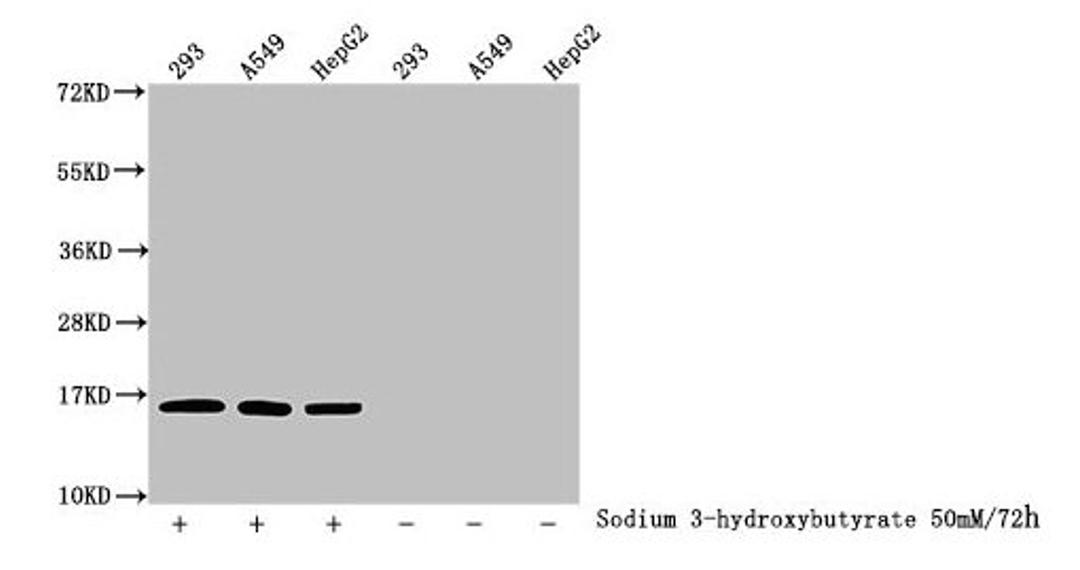 Western Blot. Detected samples: 293 whole cell lysate, A549 whole cell lysate, HepG2 whole cell lysate; Untreated (-) or treated (+) with 50mM sodium 3-hydroxybutyrate for 72h. All lanes: HIST1H3A antibody at 1:100. Secondary. Goat polyclonal to rabbit IgG at 1/50000 dilution. Predicted band size: 16 kDa. Observed band size: 16 kDa