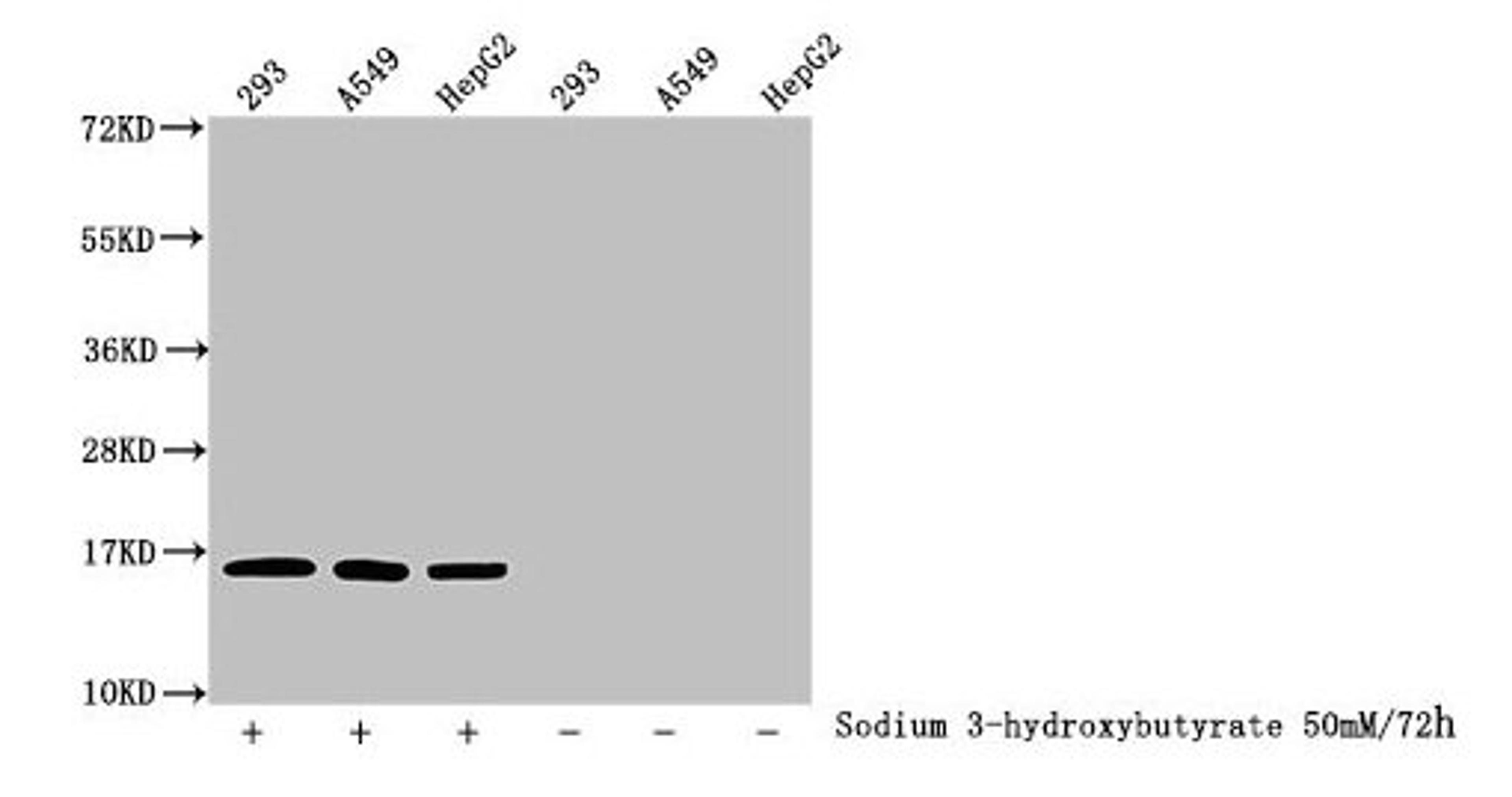 Western Blot. Detected samples: 293 whole cell lysate, A549 whole cell lysate, HepG2 whole cell lysate; Untreated (-) or treated (+) with 50mM sodium 3-hydroxybutyrate for 72h. All lanes: HIST1H3A antibody at 1:100. Secondary. Goat polyclonal to rabbit IgG at 1/50000 dilution. Predicted band size: 16 kDa. Observed band size: 16 kDa
