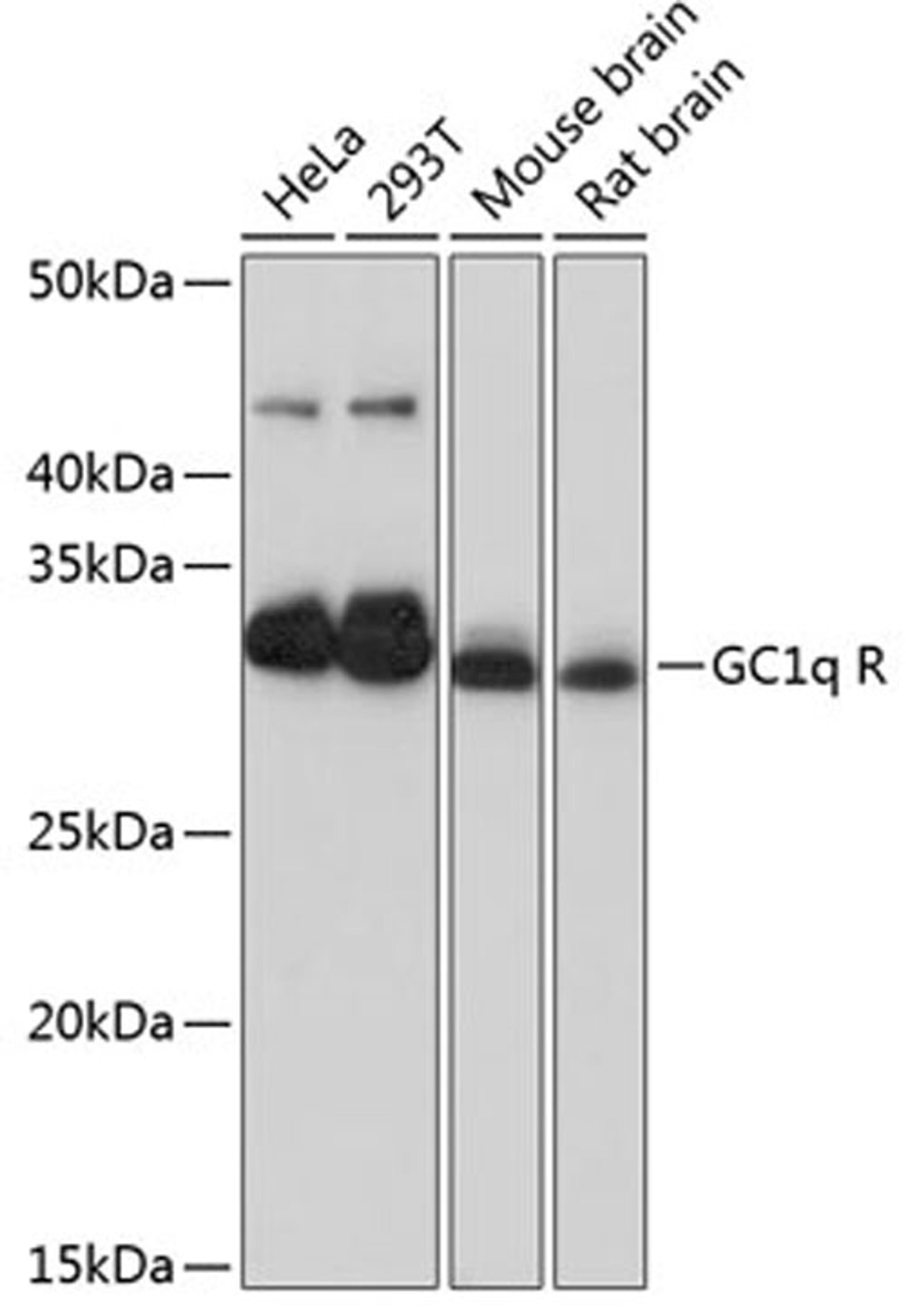 Western blot - GC1q R Rabbit mAb (A11292)