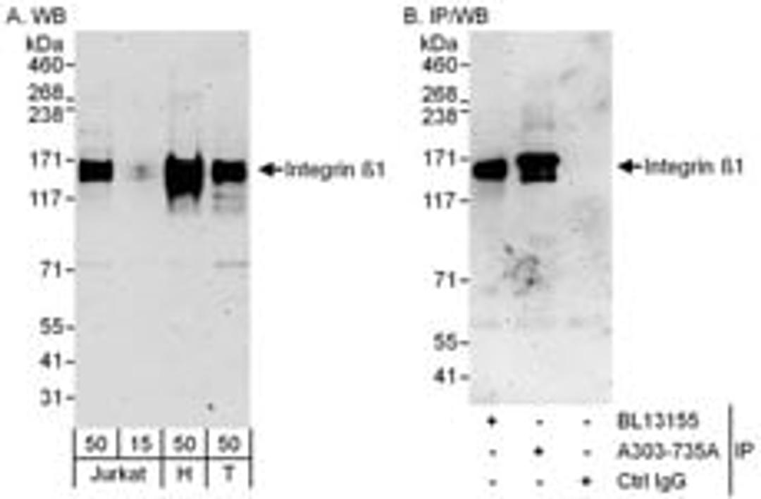 Detection of human Integrin Beta 1 by western blot and immunoprecipitation.