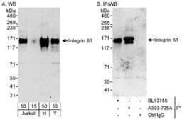 Detection of human Integrin Beta 1 by western blot and immunoprecipitation.