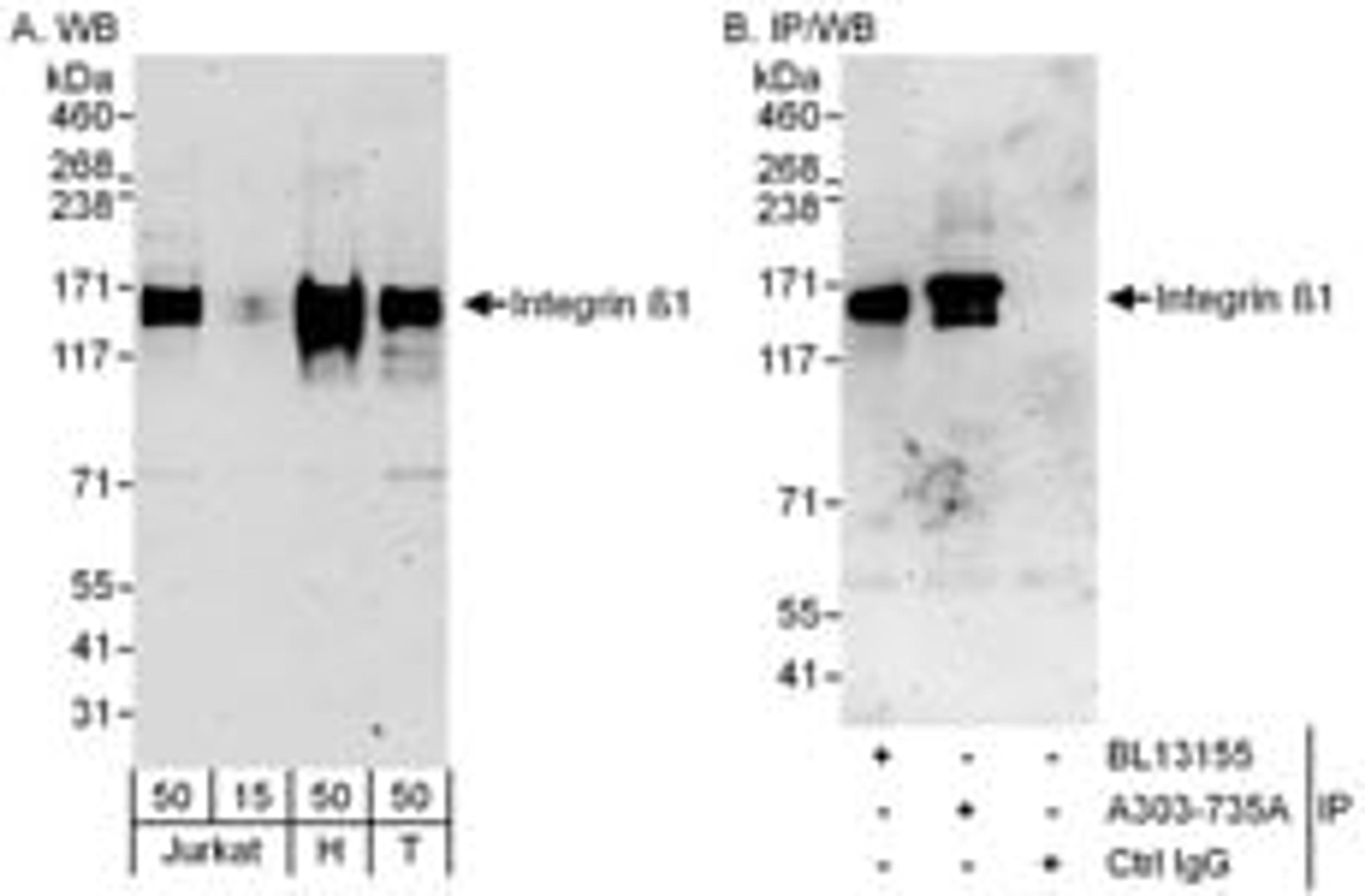 Detection of human Integrin Beta 1 by western blot and immunoprecipitation.