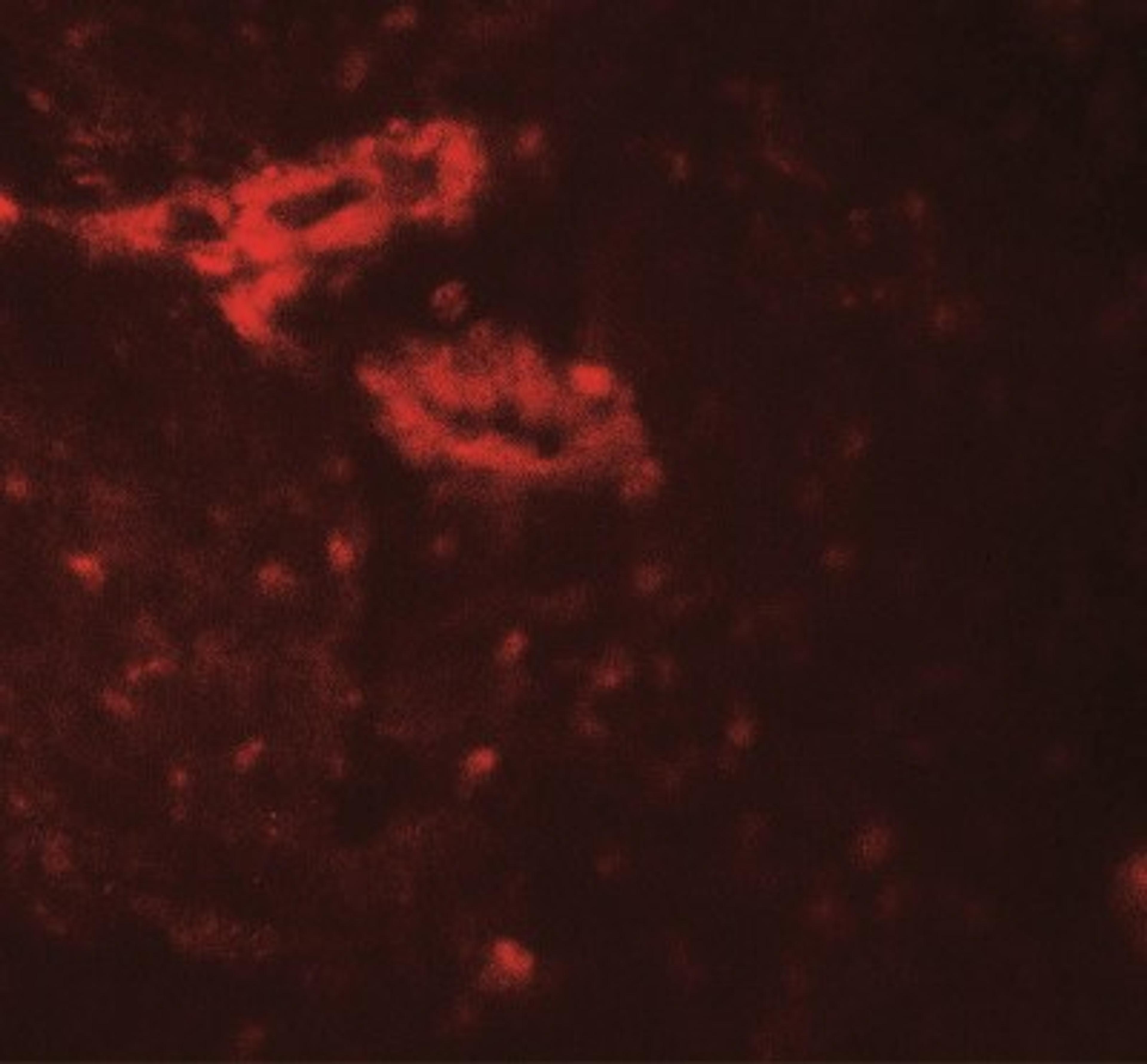 Immunocytochemistry/Immunofluorescence: IL-36 gamma/IL-1F9 Antibody [NBP2-41240] - Immunofluorescence of IL-36G in human bladder tissue with IL-36G antibody at 20 ug/mL.