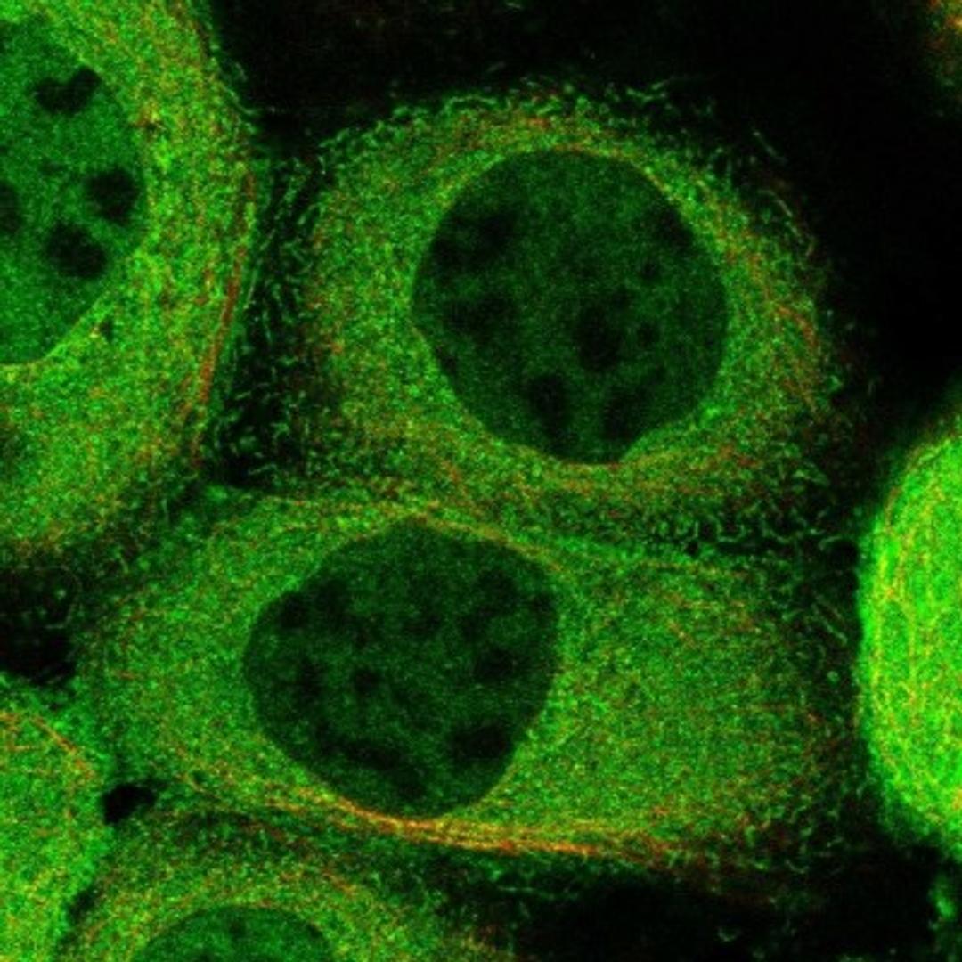 Immunofluorescence: MBD3L1 Antibody [NBP2-30978] - Immunofluorescent staining of human cell line A-431 shows positivity in nucleus but not nucleoli, plasma membrane & cytoplasm.