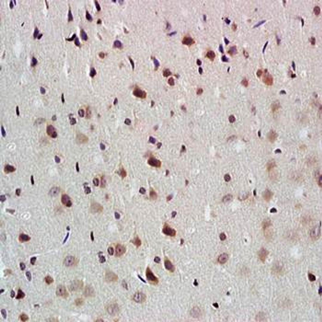 Immunohistochemical analysis of formalin-fixed and paraffin embedded rat brain tissue (dilution at:1:200) using NADPH antibody