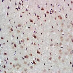 Immunohistochemical analysis of formalin-fixed and paraffin embedded rat brain tissue (dilution at:1:200) using NADPH antibody