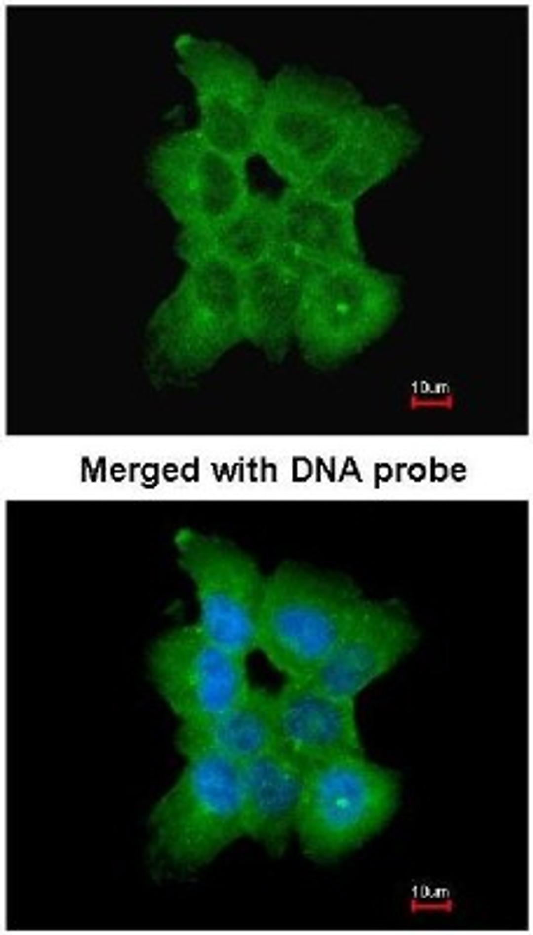 Immunocytochemistry/Immunofluorescence: CD2a Antibody [NBP1-33492] - Paraformaldehyde-fixed A431, using CD2-associated protein (NBP1-33492) antibody at 1:200 dilution.