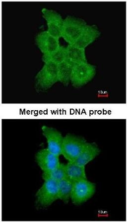 Immunocytochemistry/Immunofluorescence: CD2a Antibody [NBP1-33492] - Paraformaldehyde-fixed A431, using CD2-associated protein (NBP1-33492) antibody at 1:200 dilution.