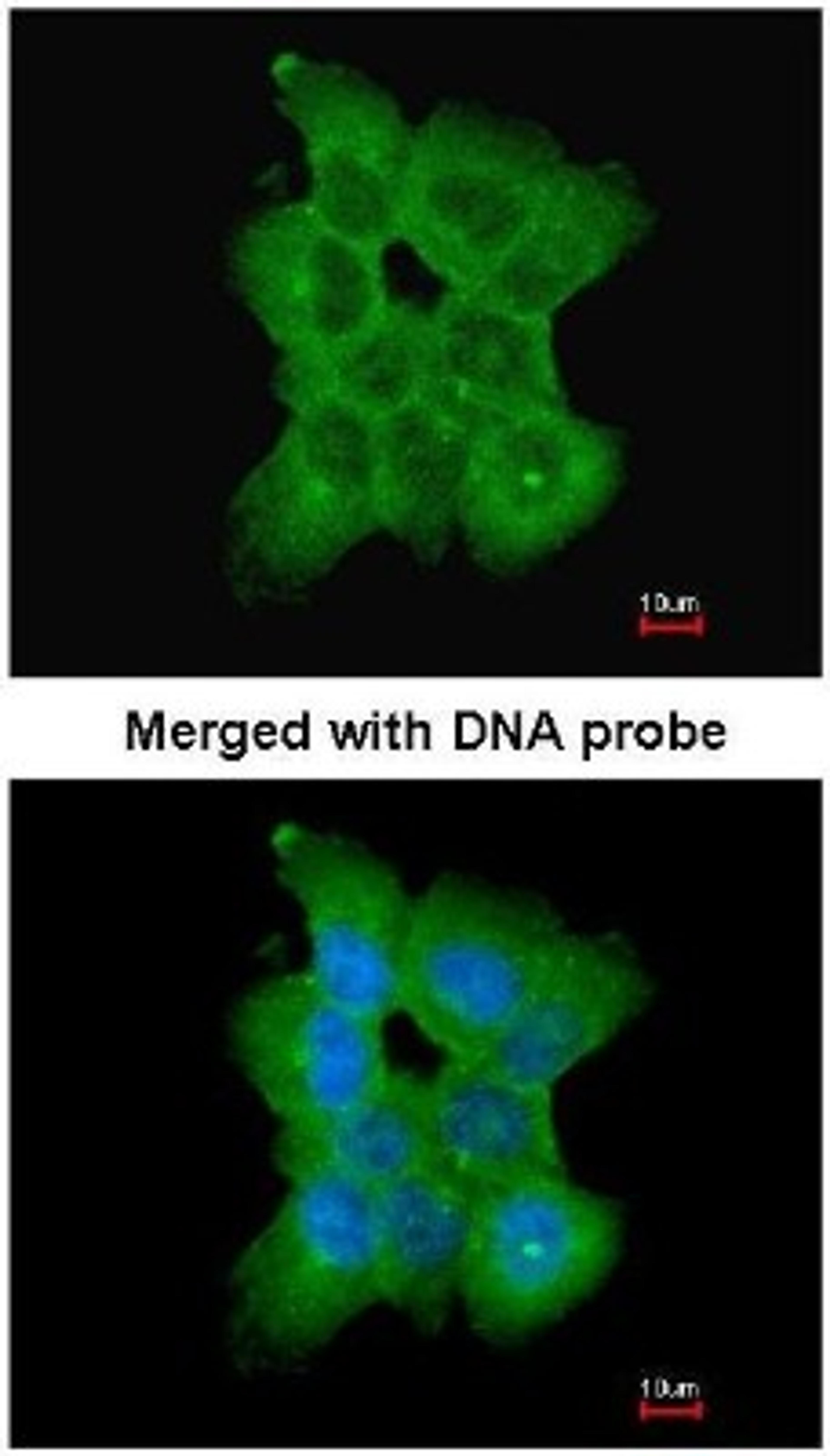 Immunocytochemistry/Immunofluorescence: CD2a Antibody [NBP1-33492] - Paraformaldehyde-fixed A431, using CD2-associated protein (NBP1-33492) antibody at 1:200 dilution.