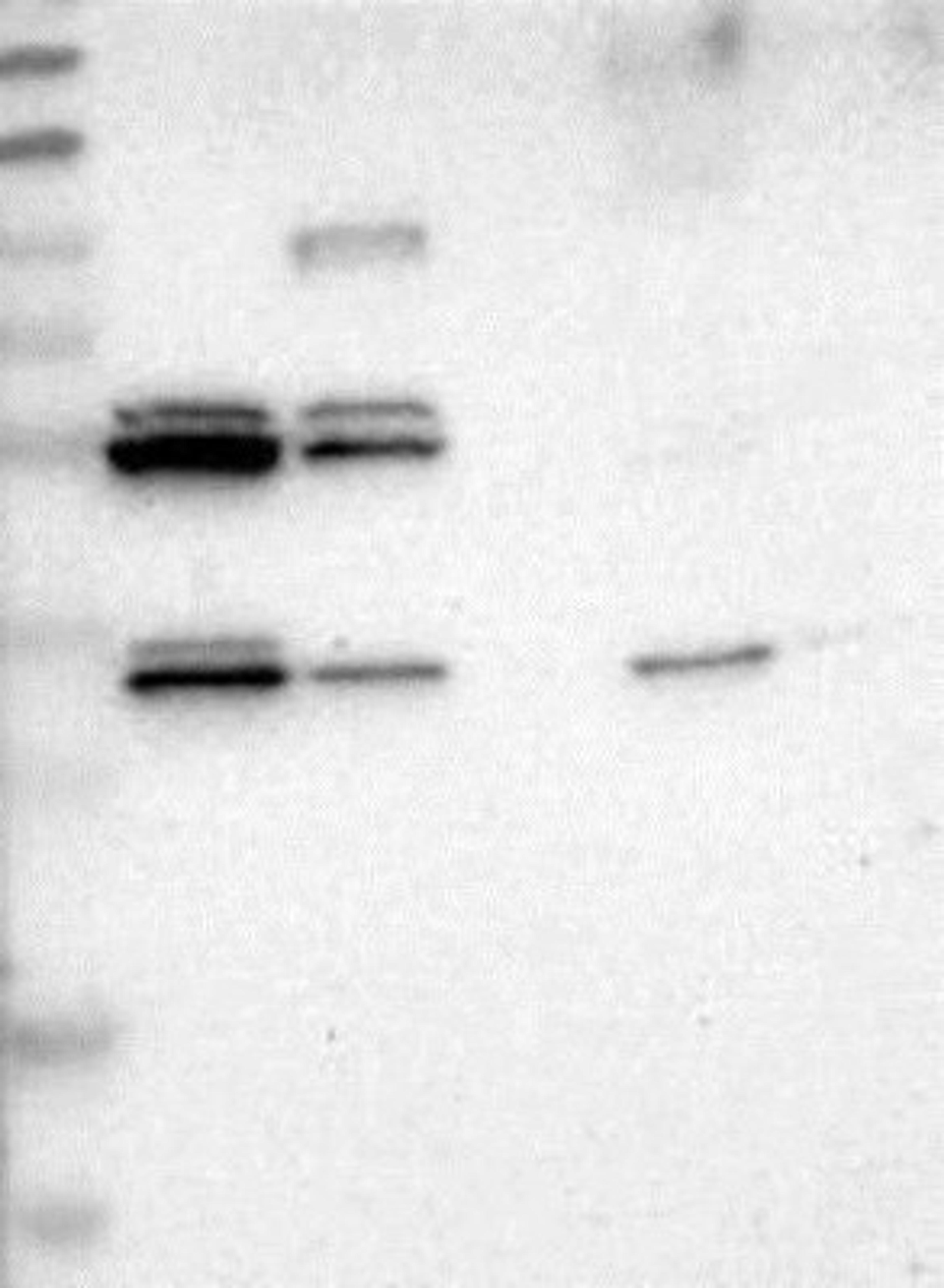 Western Blot: FAM188B Antibody [NBP1-91239] - Lane 1: Marker [kDa] 230, 130, 95, 72, 56, 36, 28, 17, 11<br/>Lane 2: RT-4<br/>Lane 3: U-251 MG<br/>Lane 4: Human Plasma<br/>Lane 5: Liver<br/>Lane 6: Tonsil