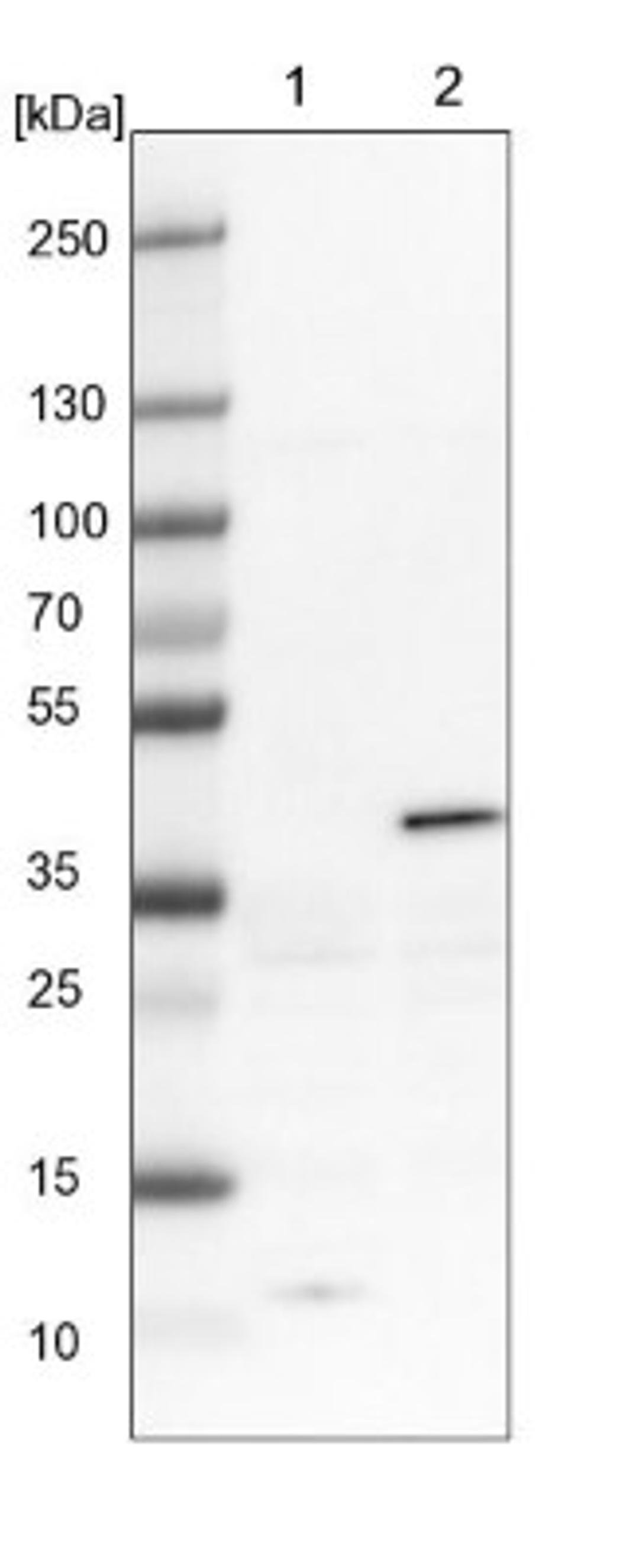 Western Blot: Serpin B5/Maspin Antibody [NBP1-87778] - Lane 1: NIH-3T3 cell lysate (Mouse embryonic fibroblast cells)<br/>Lane 2: NBT-II cell lysate (Rat Wistar bladder tumour cells)