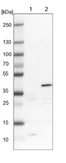 Western Blot: Serpin B5/Maspin Antibody [NBP1-87778] - Lane 1: NIH-3T3 cell lysate (Mouse embryonic fibroblast cells)<br/>Lane 2: NBT-II cell lysate (Rat Wistar bladder tumour cells)