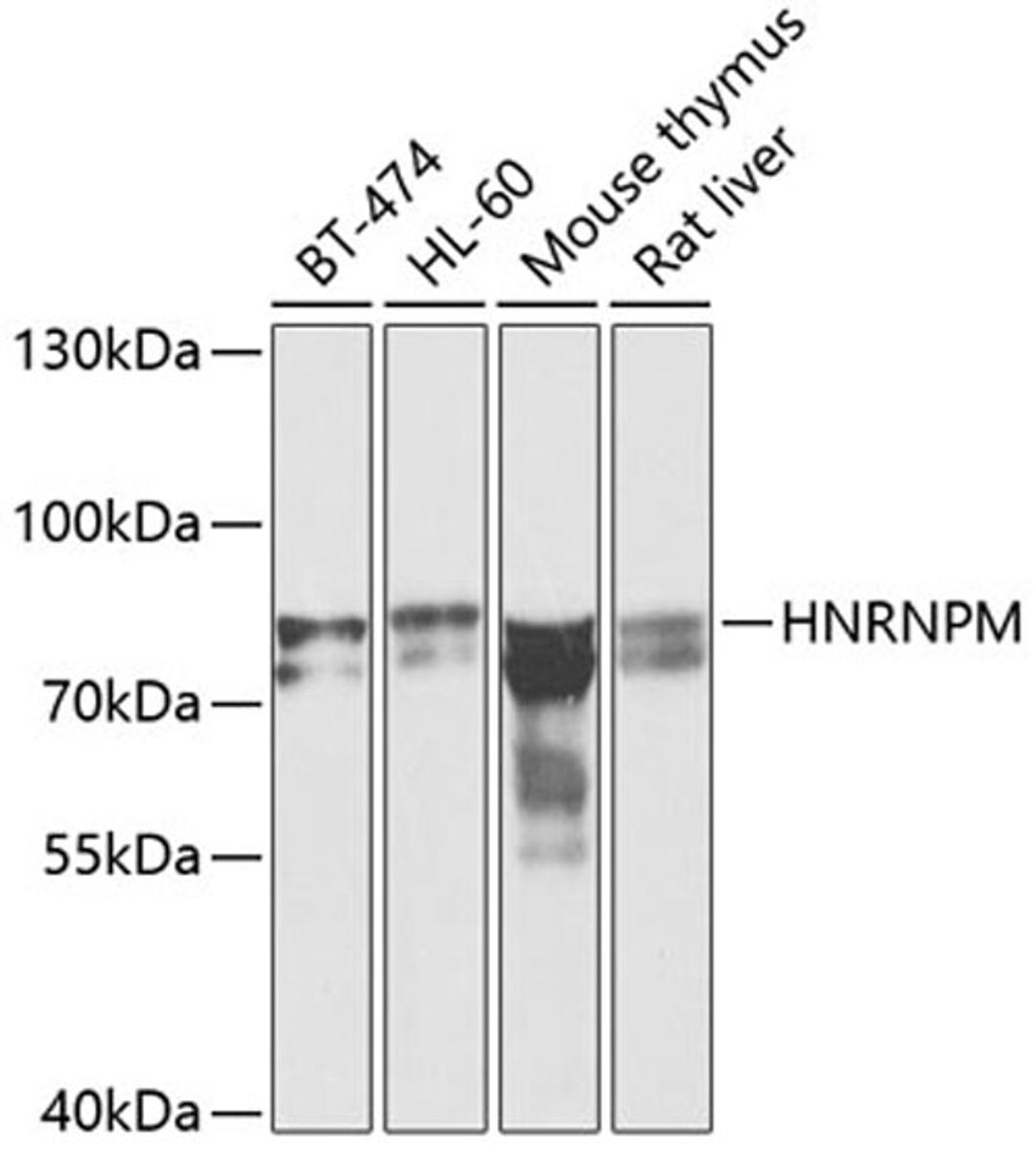 Western blot - HNRNPM antibody (A6937)