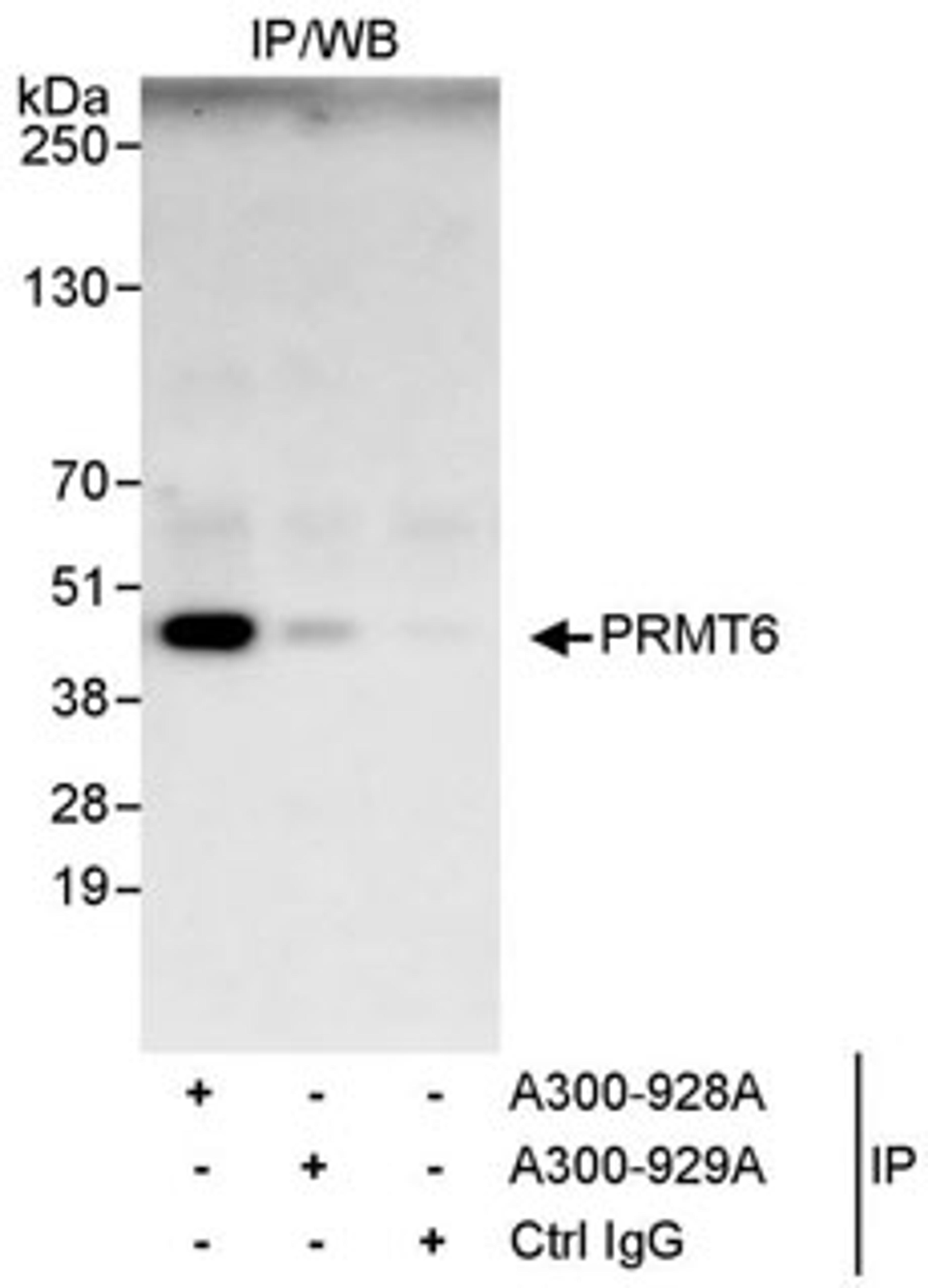 Detection of human PRMT6 by western blot of immunoprecipitates.