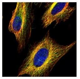 Immunocytochemistry/Immunofluorescence: VDAC2 Antibody [NBP2-20849] - Confocal immunofluorescence analysis of methanol-fixed HeLa, using VDAC2 antibody (Green) at 1:500 dilution. Alpha-tubulin filaments are labeled with Alpha-tubulin antibody (Red) at 1:2000.