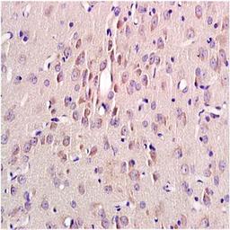 Paraffin-embedded rat brain tissue fixed with 4% paraformaldehyde. Antigen retrieval by boiling with citrate buffer. Blocking buffer is goat serum (37 degrees for 20 min.). MSH alpha antibody at 1:200 dilution with overnight incubation at 4 degrees