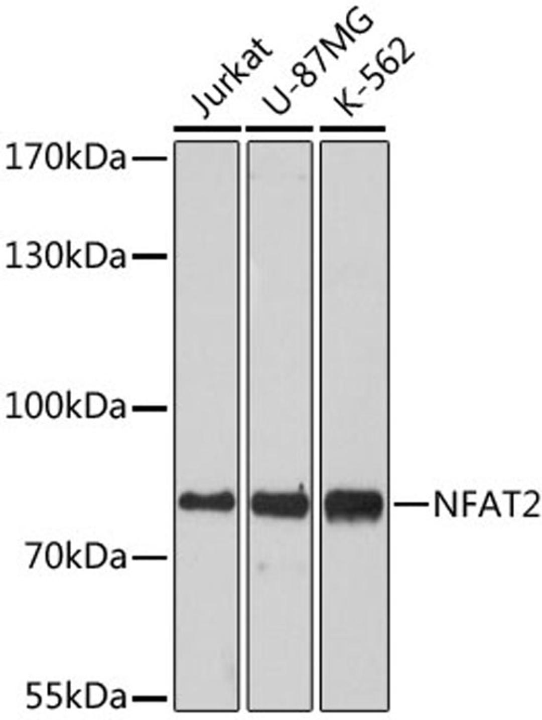 Western blot - NFAT2 antibody (A1539)