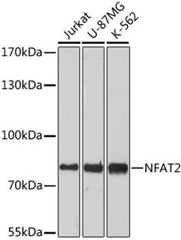 Western blot - NFAT2 antibody (A1539)