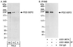 Detection of human PDZ-GEF2 by western blot and immunoprecipitation.