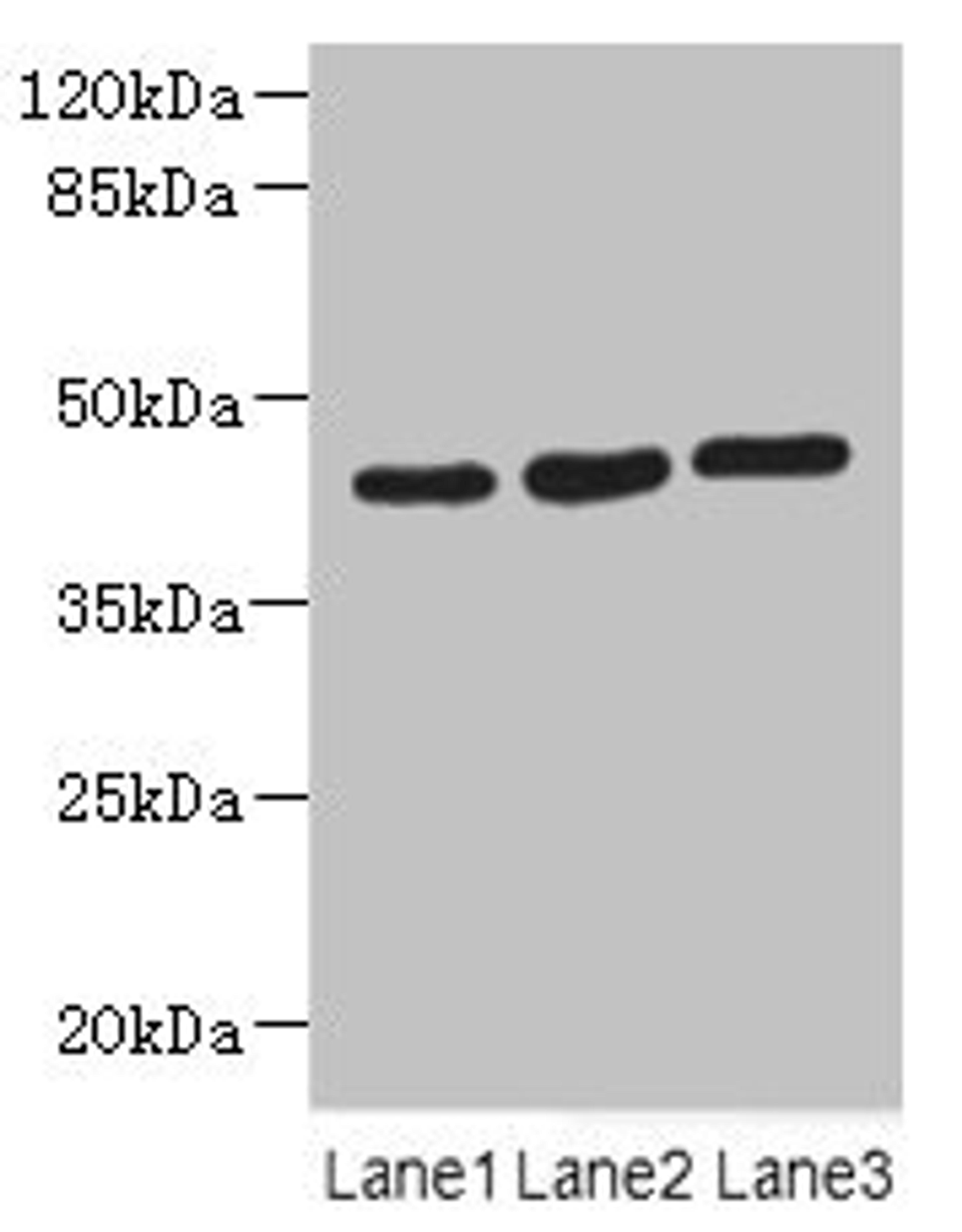Western blot. All lanes: MAPKAPK3 antibody at 4.4µg/ml. Lane 1: Hela whole cell lysate. Lane 2: Jurkat whole cell lysate. Lane 3: MCF-7 whole cell lysate. Secondary. Goat polyclonal to rabbit IgG at 1/10000 dilution. Predicted band size: 43 kDa. Observed band size: 43 kDa