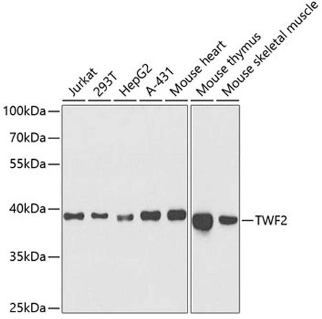 Western blot - TWF2 antibody (A5860)