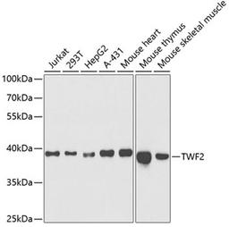 Western blot - TWF2 antibody (A5860)