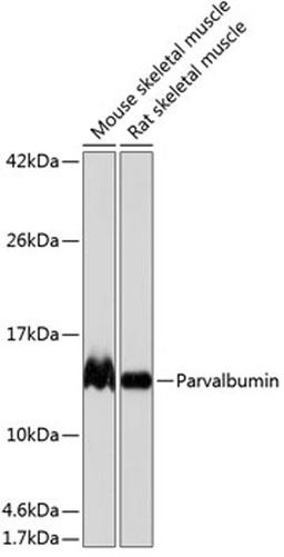 Western blot - Parvalbumin antibody (A19098)