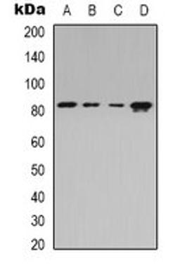 Western blot analysis of Jurkat (Lane 1), HEK293T (Lane 2), Raw264.7 (Lane 3), rat spleen (Lane 4) whole cell lysates using Beta-adducin antibody