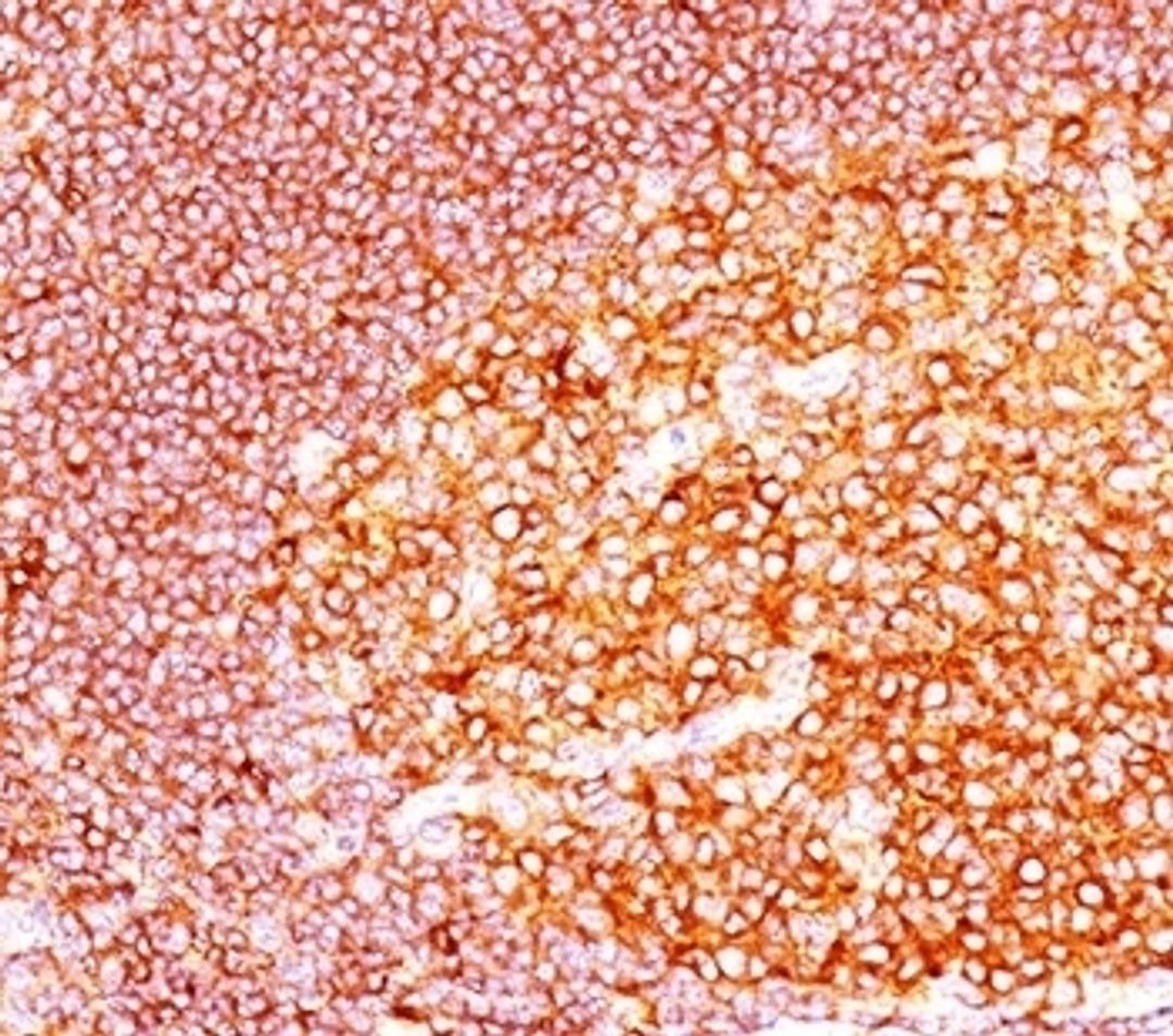 IHC staining of tonsil tissue with MALT1 antibody (MT1/410).