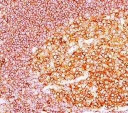 IHC staining of tonsil tissue with MALT1 antibody (MT1/410).