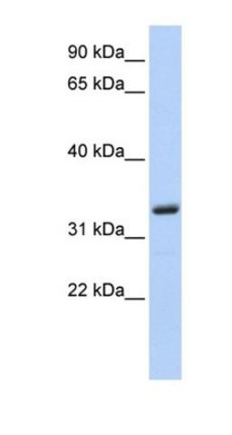 Western blot analysis of 721_B cell lysate tissue using MS4A4A antibody