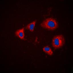 Immunofluorescense analysis of HEK293T cells using Aurora A (phospho-T288) antibody