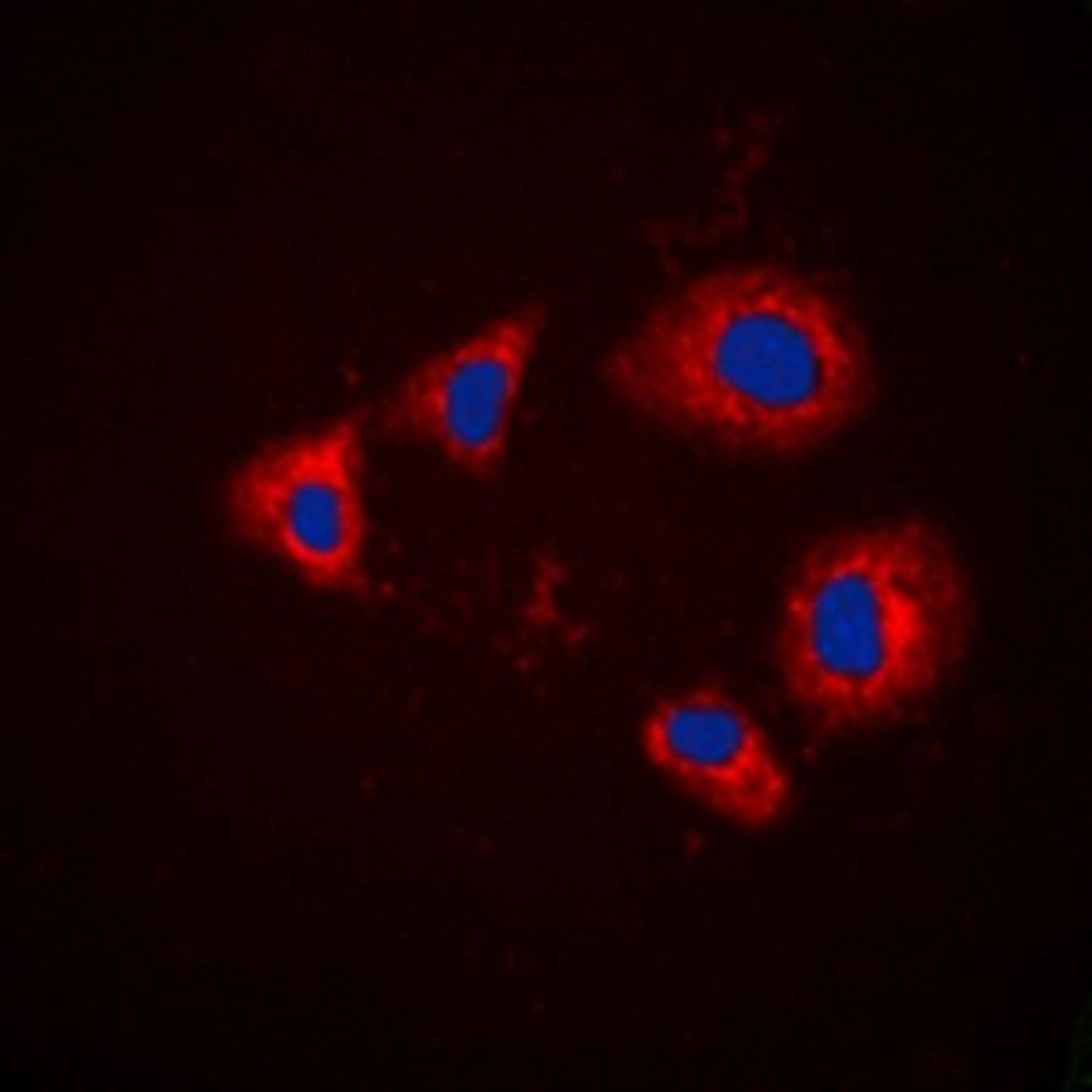 Immunofluorescense analysis of HEK293T cells using Aurora A (phospho-T288) antibody