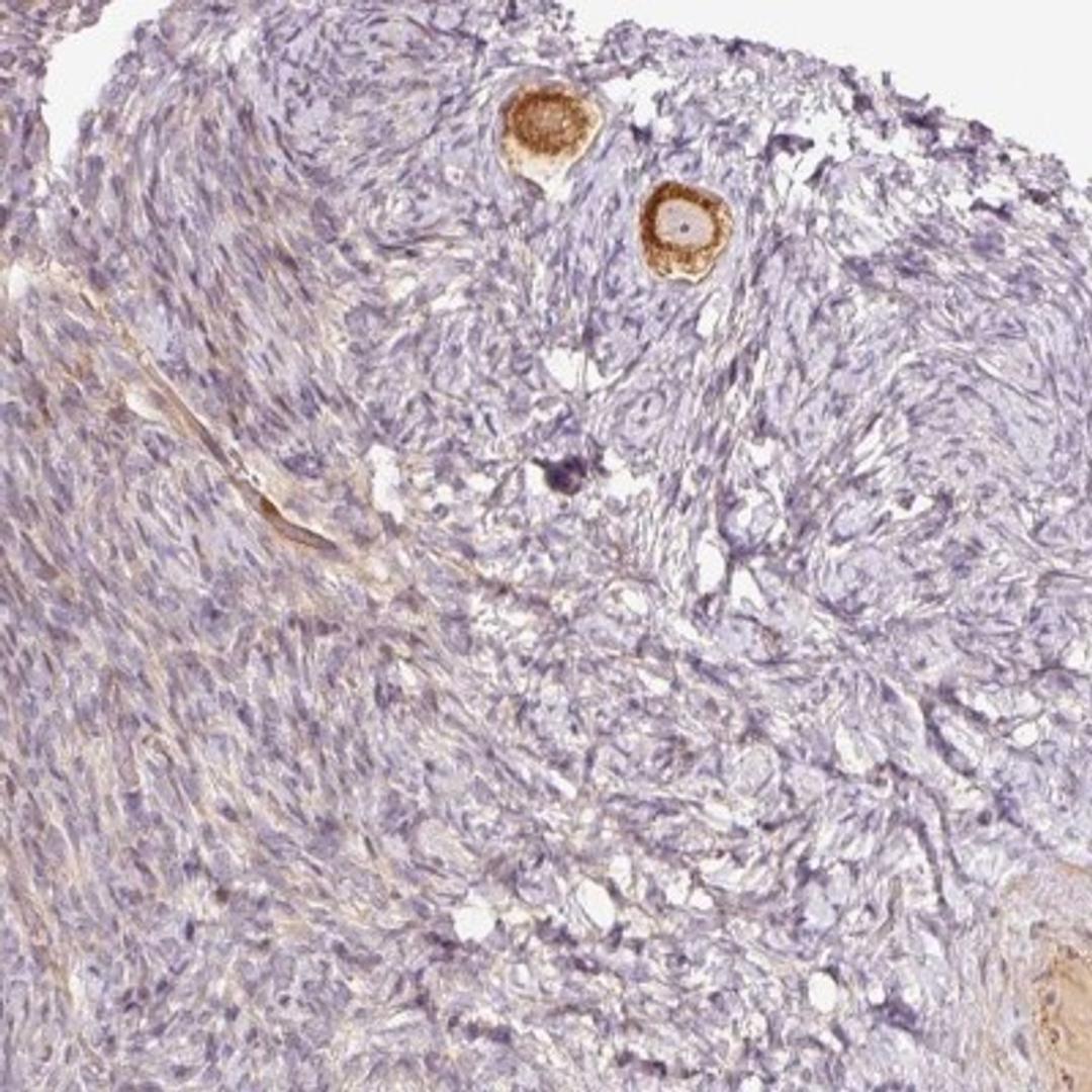 Immunohistochemistry: SLC29A3 Antibody [NBP2-31589] - Immunohistochemical staining of human ovary shows strong cytoplasmic positivity in follicle cells.