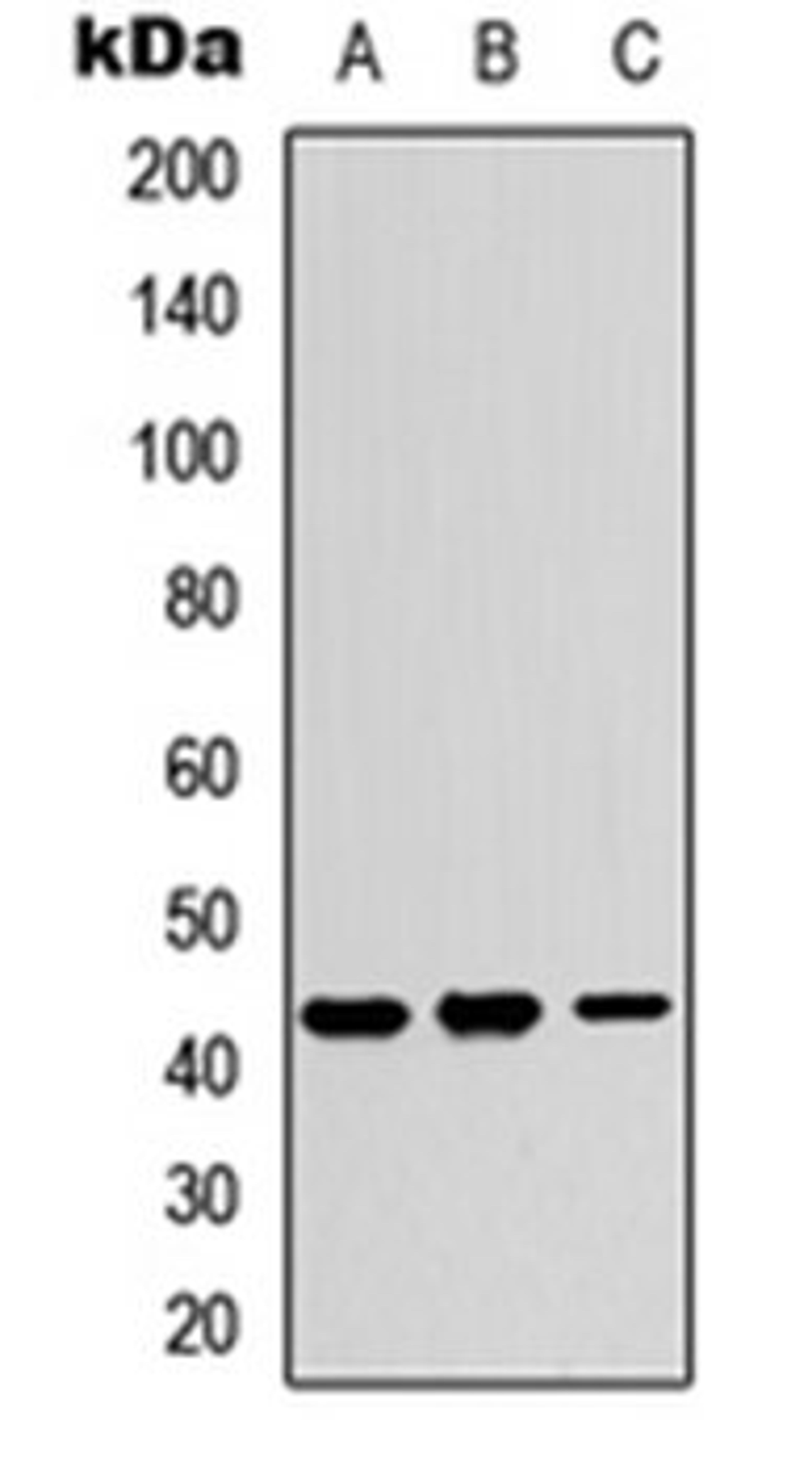 Western blot analysis of A549 (Lane 1), NS-1 (Lane 2), PC12 (Lane 3) whole cell lysates using Kir4.2 antibody