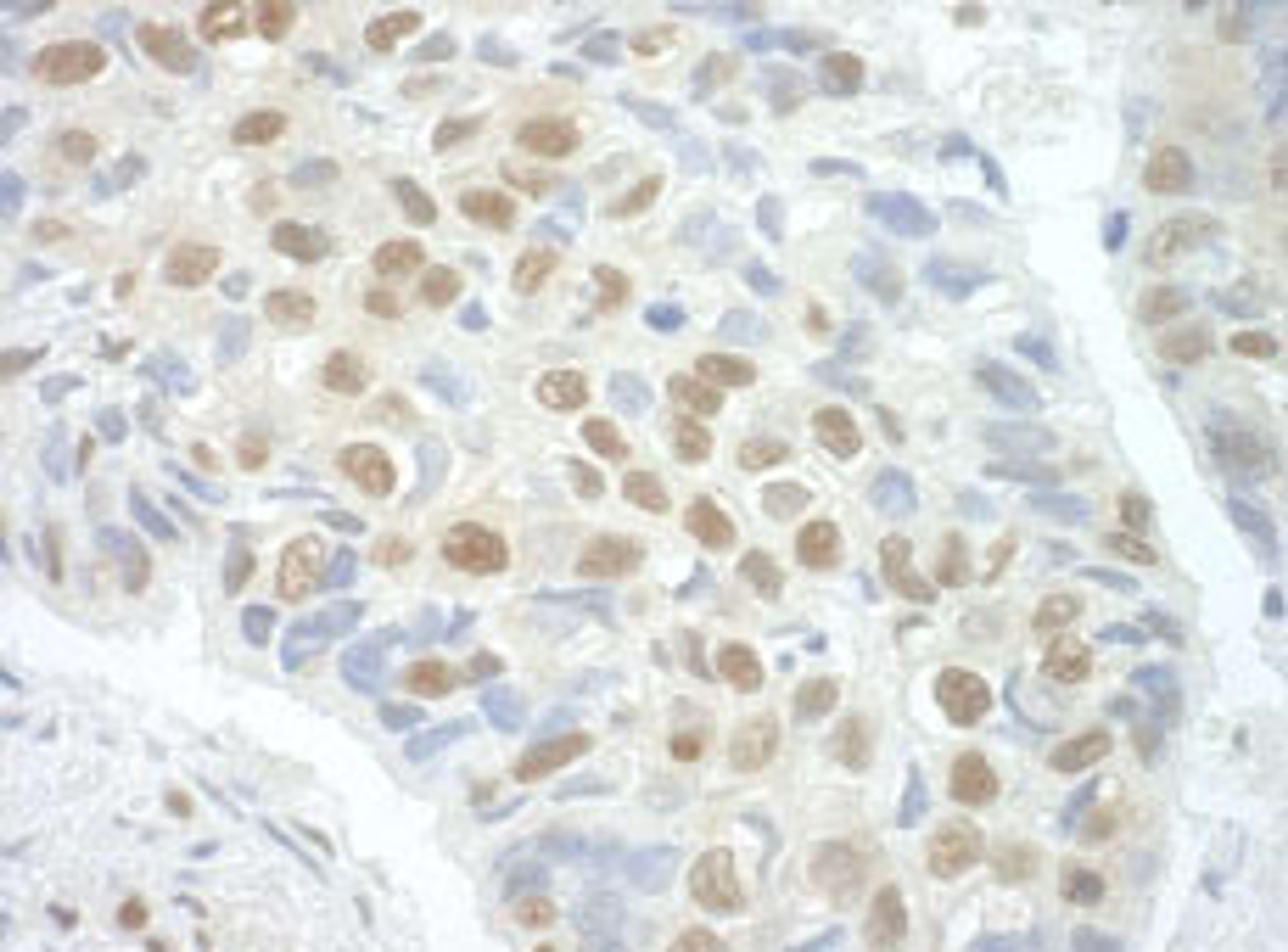 Detection of human POGZ by immunohistochemistry.