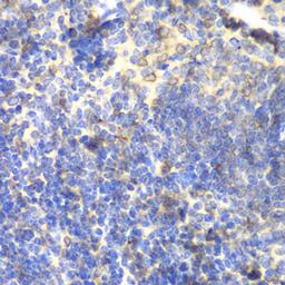 Immunohistochemistry - BTK antibody (A1576)