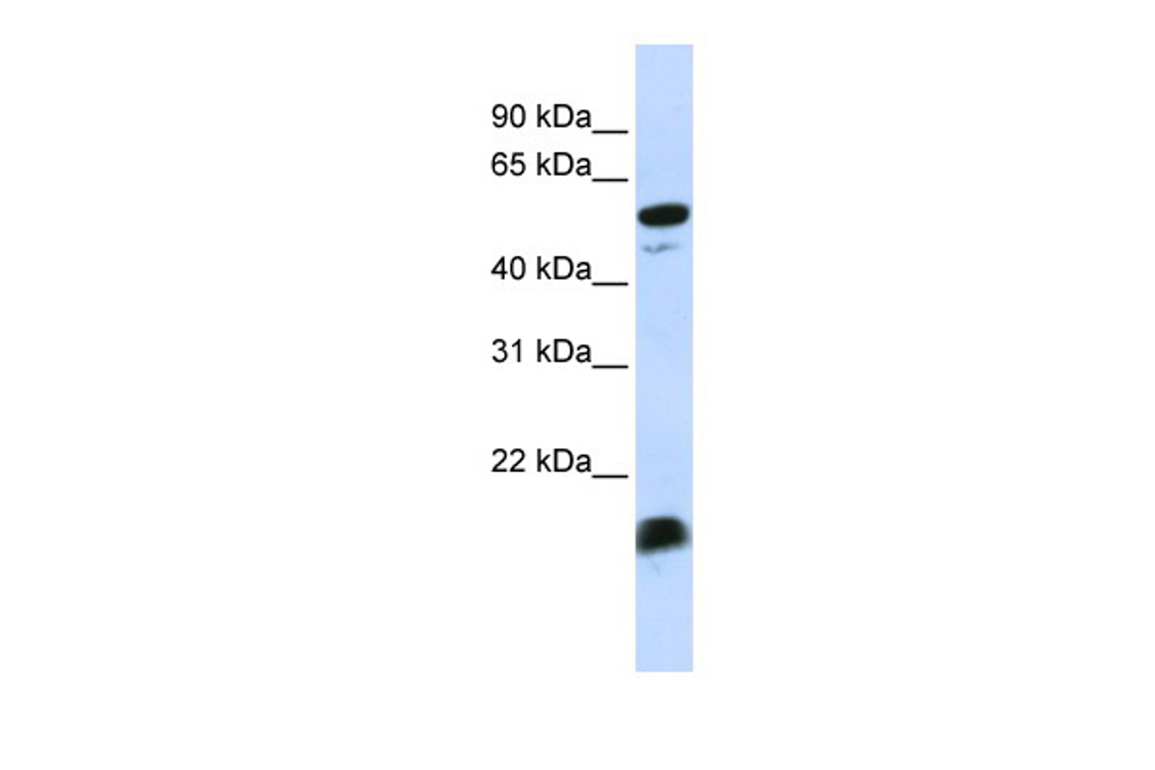 Antibody used in WB on Human MCF-7 at 0.2-1 ug/ml.