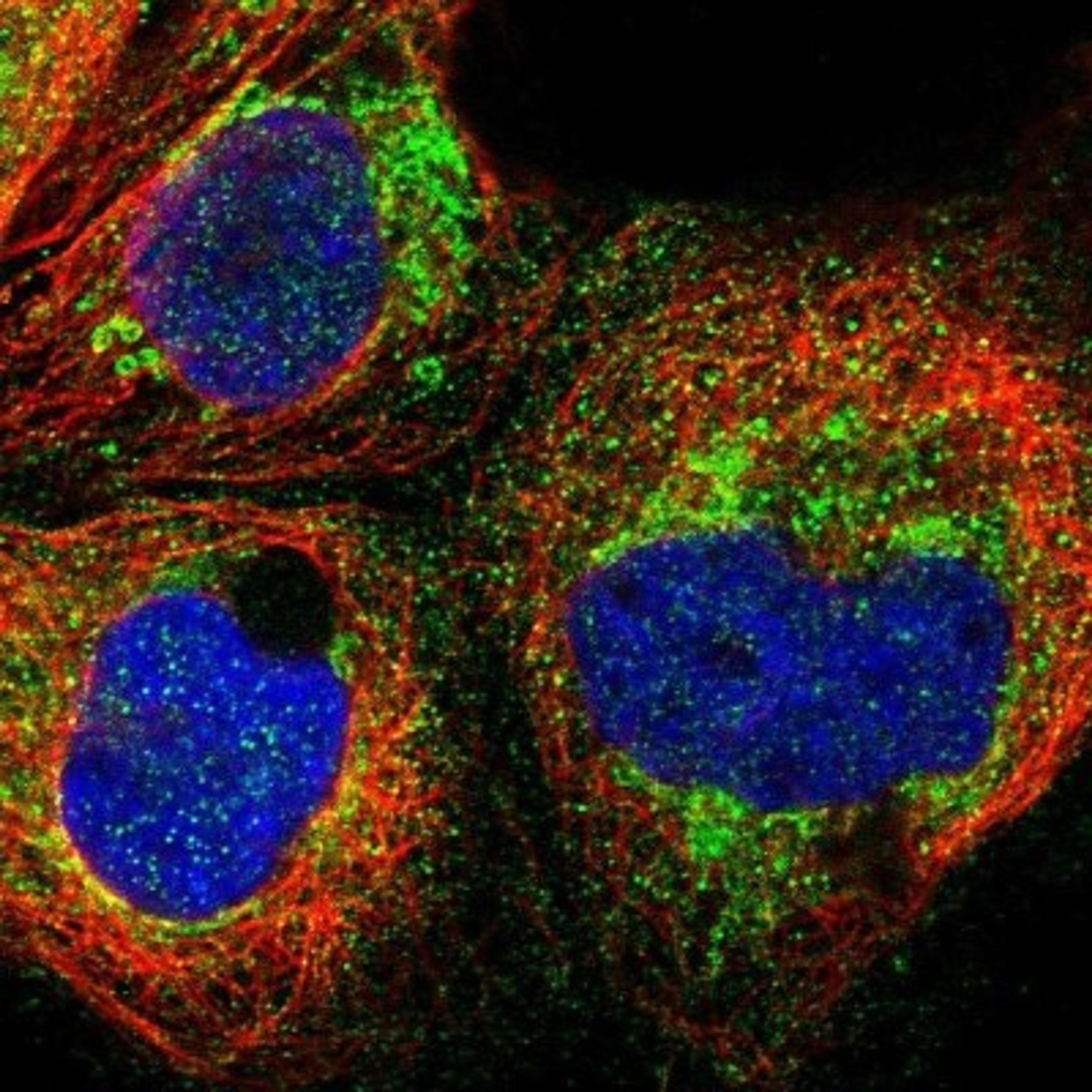 Immunocytochemistry/Immunofluorescence: TMIGD1 Antibody [NBP1-80672] - Immunofluorescent staining of human cell line A-431 shows positivity in cytoplasm & mitochondria.