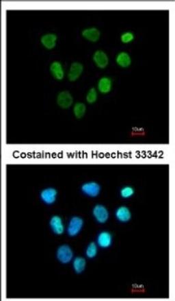 Immunocytochemistry/Immunofluorescence: XPA Antibody [NBP2-20919] - Immunofluorescence analysis of paraformaldehyde-fixed A431, using antibody at 1:200 dilution.