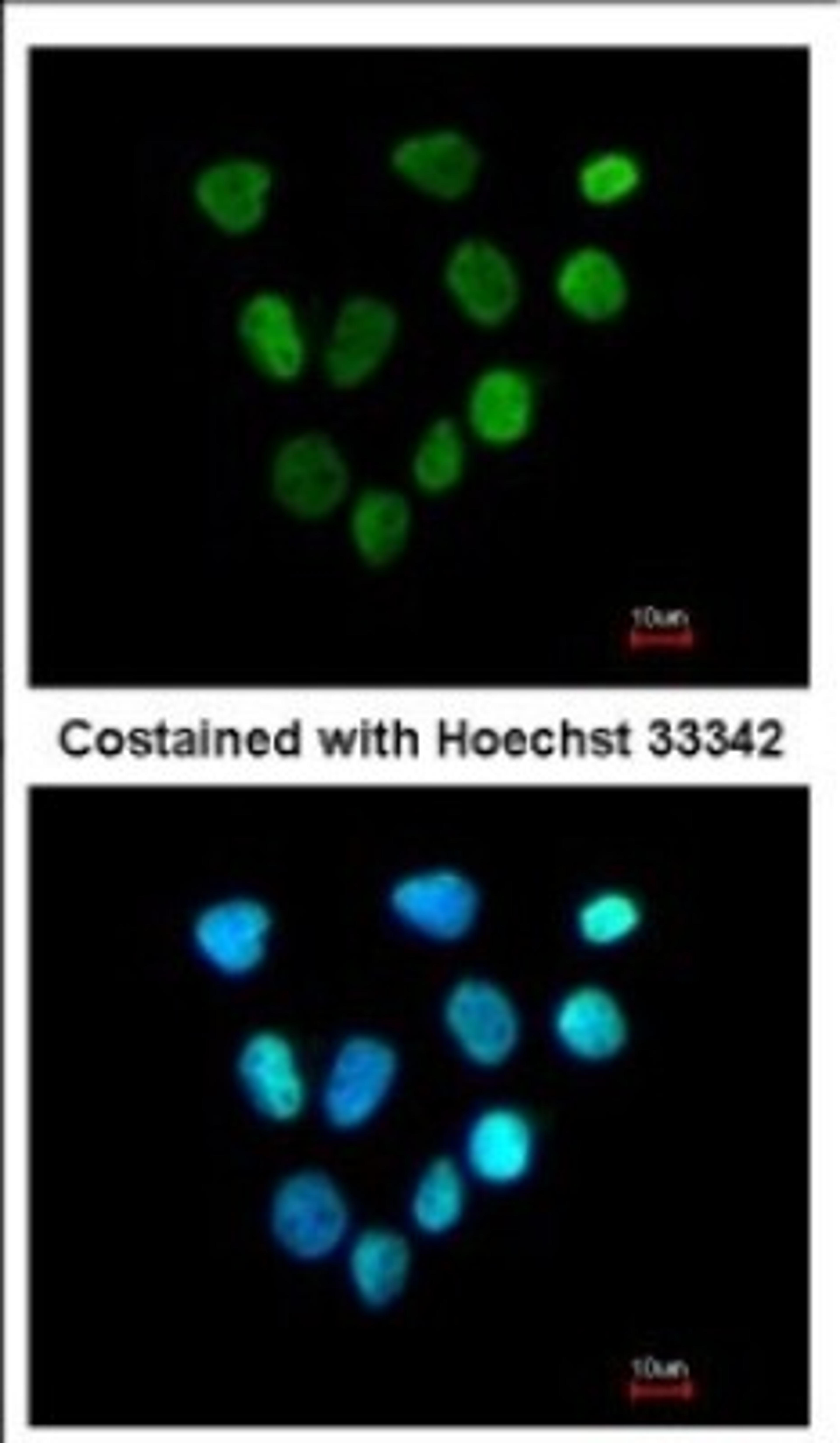 Immunocytochemistry/Immunofluorescence: XPA Antibody [NBP2-20919] - Immunofluorescence analysis of paraformaldehyde-fixed A431, using antibody at 1:200 dilution.