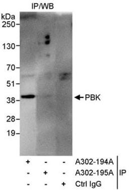 Detection of human PBK by western blot of immunoprecipitates.