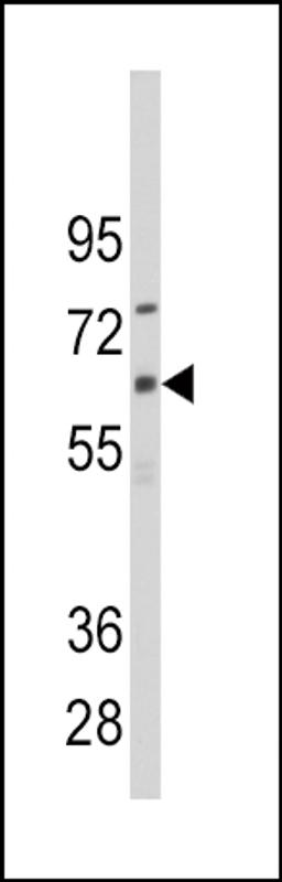 Western blot analysis of anti-CYP1B1 Antibody in CEM cell line lysates (35ug/lane).