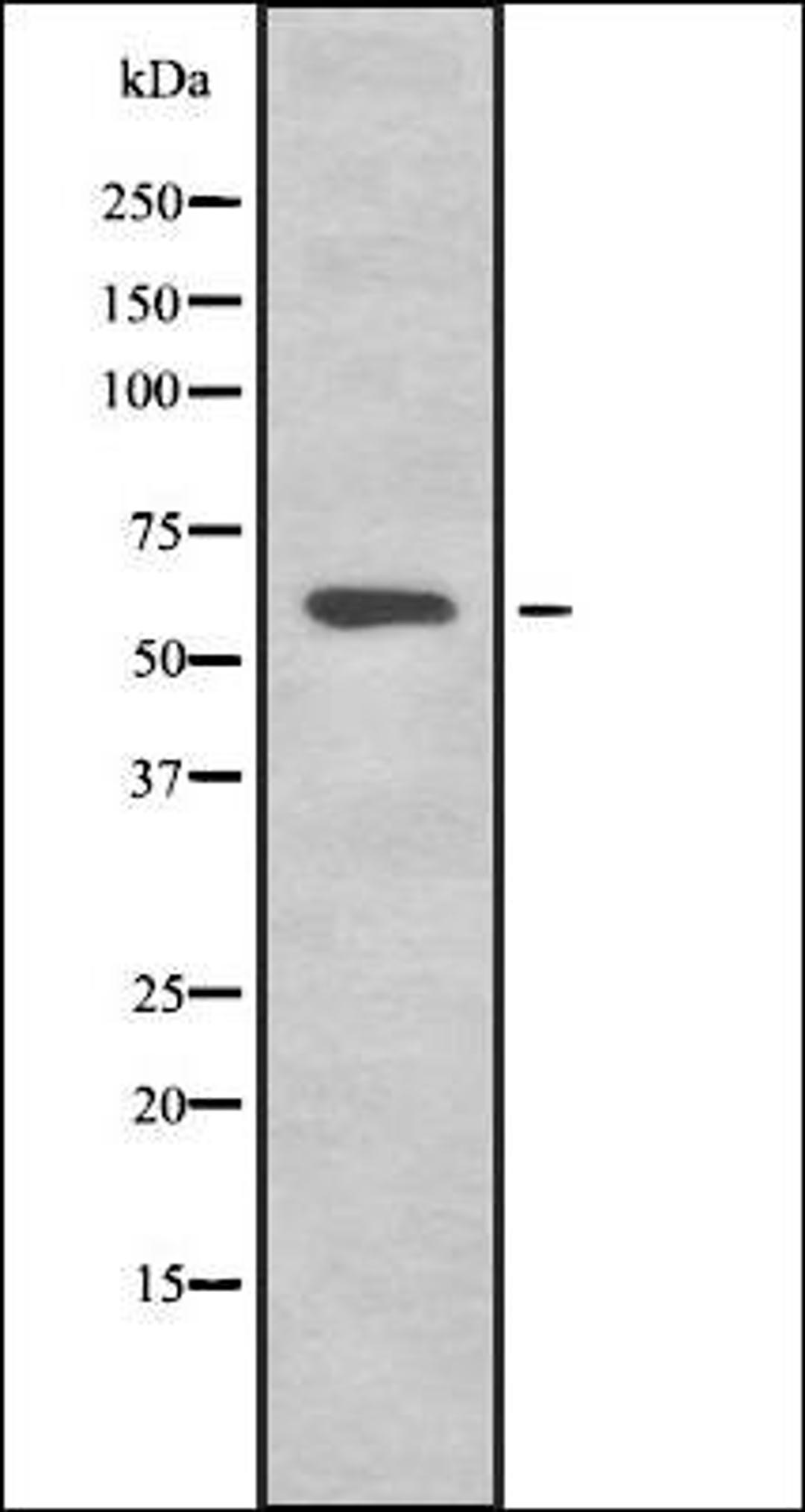 Western blot analysis of HEK293 cells using K2C1B antibody