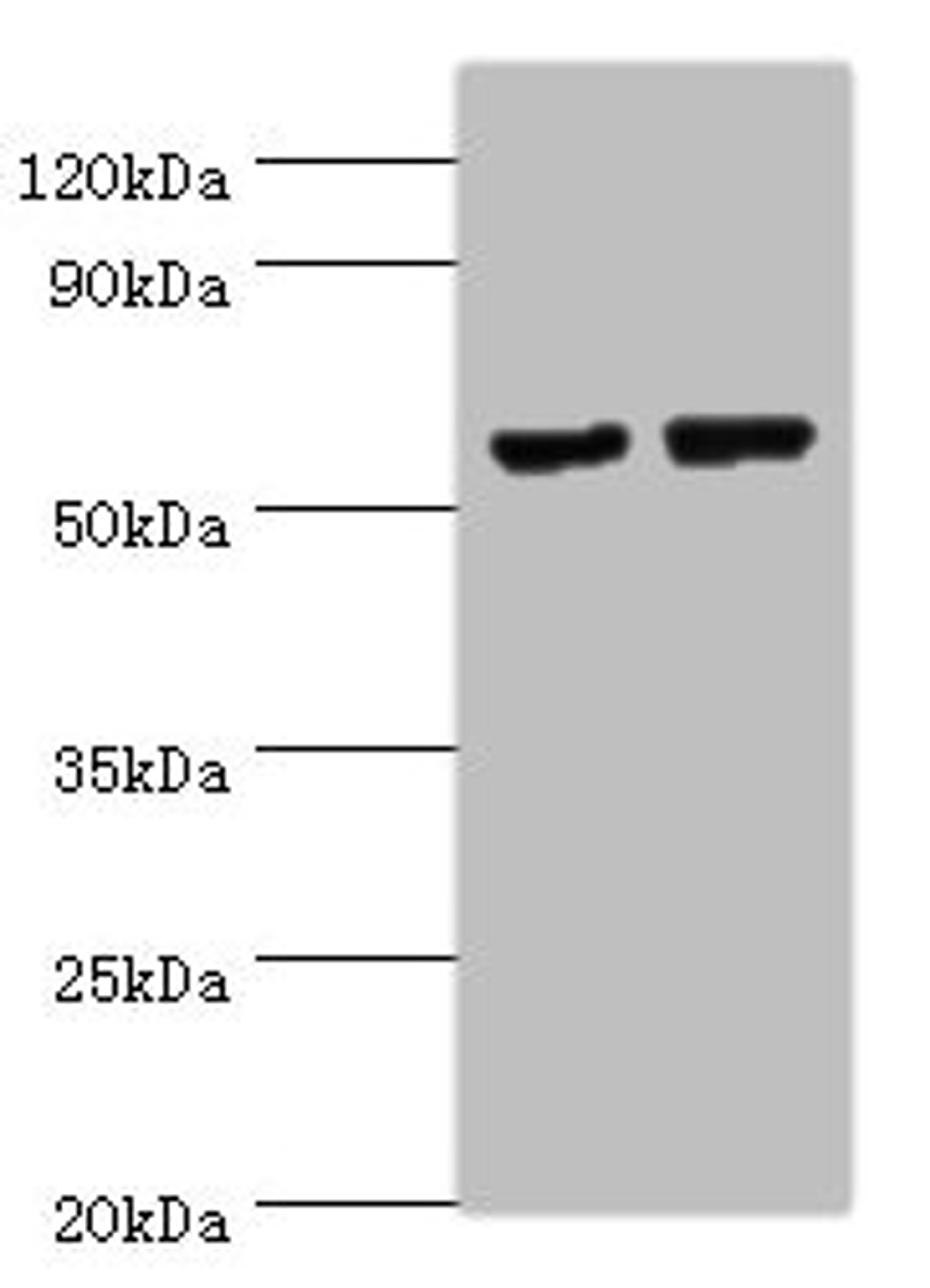 Western blot. All lanes: MATN3 antibody at 14ug/ml. Lane 1: NIH/3T3 whole cell lysate. Lane 2: Mouse thymus tissue. Secondary. Goat polyclonal to rabbit IgG at 1/10000 dilution. Predicted band size: 53, 49 kDa. Observed band size: 53 kDa.