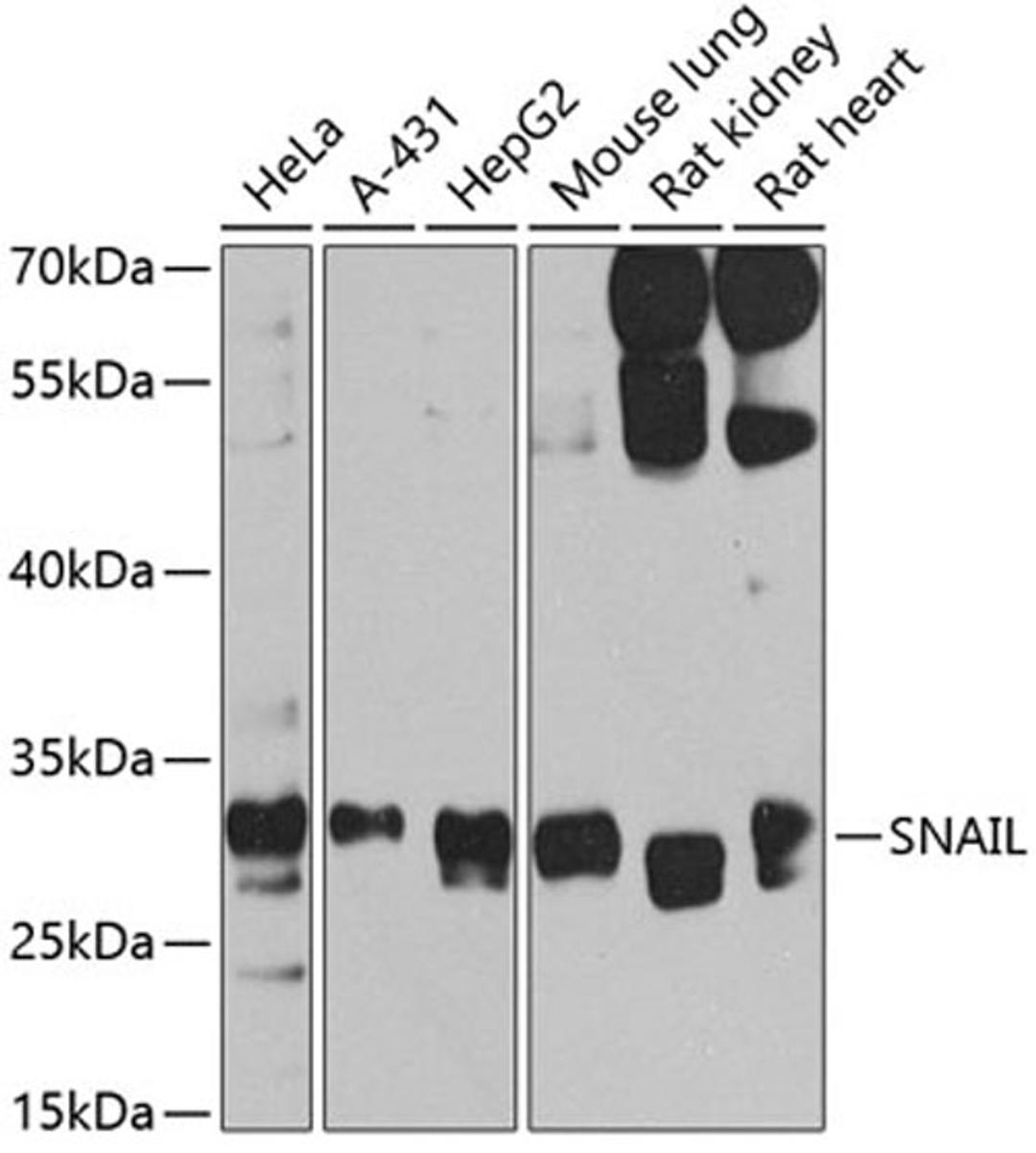 Western blot - Snail antibody (A5243)